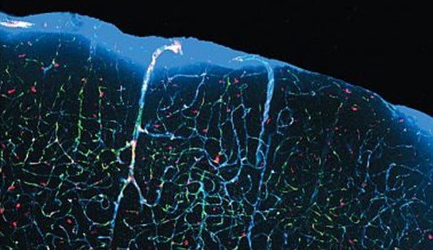 2-cerebrospinal-fluid-in-brain