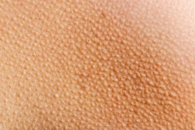 Goosebumps Skin Background