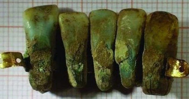 4-recycled-teeth