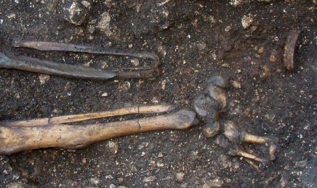 3-peg-leg-metal-band