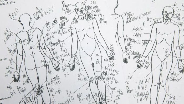 post-mortem examination