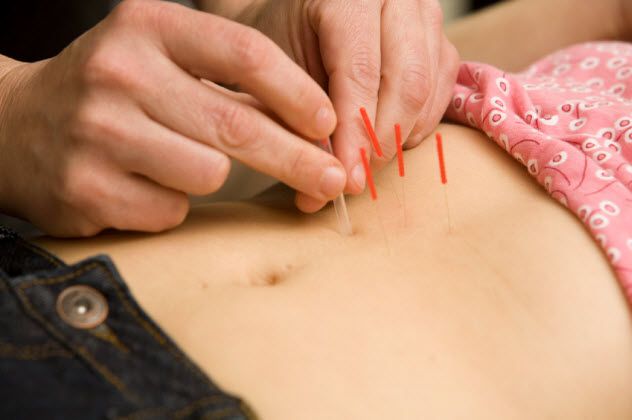 9-acupuncture_000008893520_Small