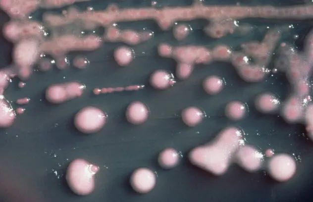 4-Klebsiella-Pneumoniae