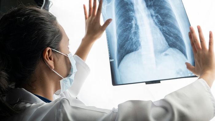 A physician examines X-ray images of a patient's lungs, pondering their implications.