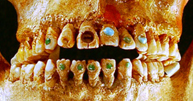 jewelteeth