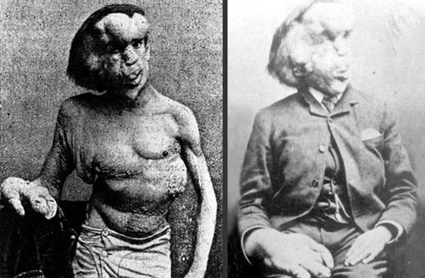 Elephant Man 01