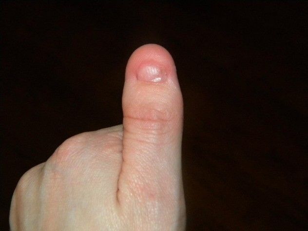 NPSthumb
