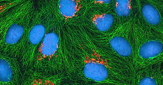 6-hela-cells