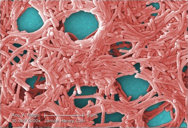 Legionella Pneumophila (Sem) 2