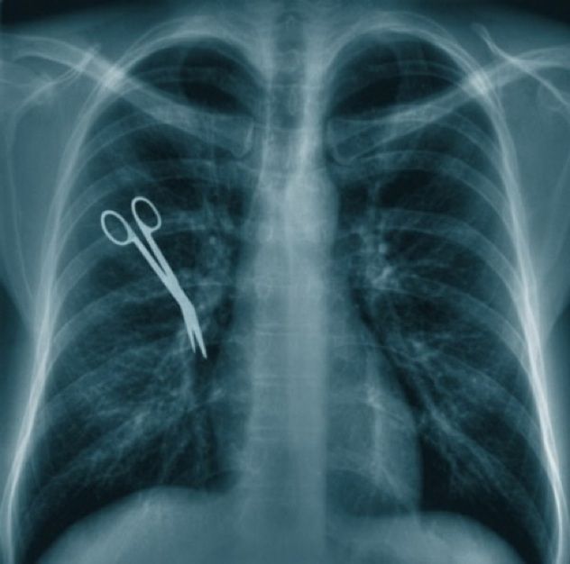 Weirdest-X-Rays-03