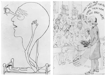 Alice In Wonderland Syndrome