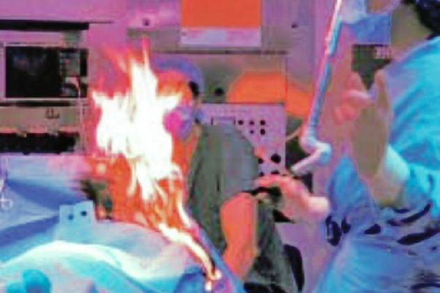 Surgical-Fire
