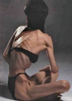 Skeleton7.Jpg