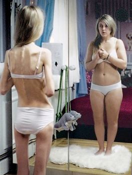 Picture 2-55 depicts a common visual representation of Body Dysmorphic Disorder symptoms and struggles, showing the contrast between self-perception and how others see the person.