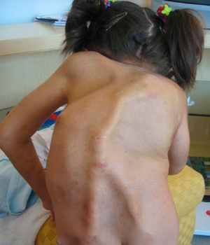 1331341-1331372-1007104-1689431