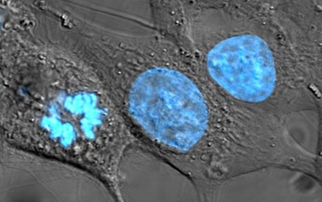 5-stained-hela-cells