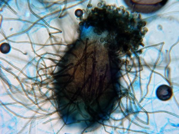 Chaetomium Ascus & Ascospores