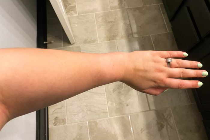 A person's arm after applying La Roche-Posay Lipikar Wash AP+ Moisturizing Body & Face Wash