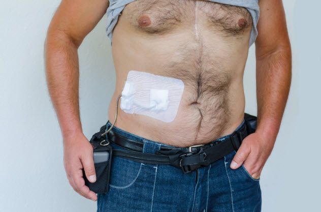 2a-lvad_000057635616_Small