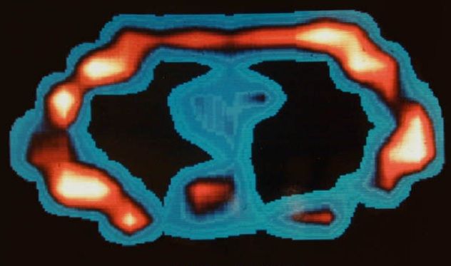mri-image