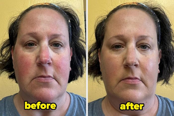 Side-by-side images showing a woman’s face, labeled for comparison.