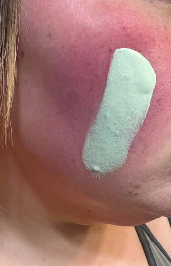 A close-up of a person's cheek with a large green skincare product patch, demonstrating how to apply the product.