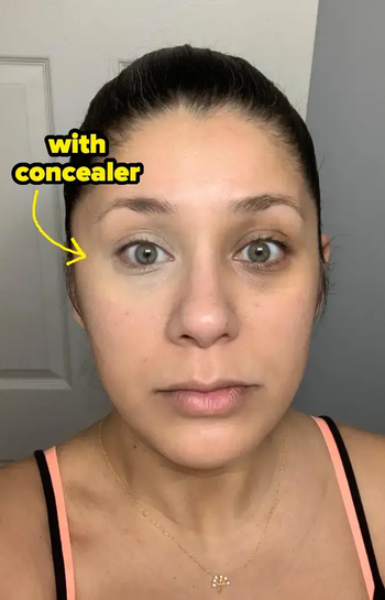 Reviewer showcasing the concealer applied to one under-eye, demonstrating excellent coverage