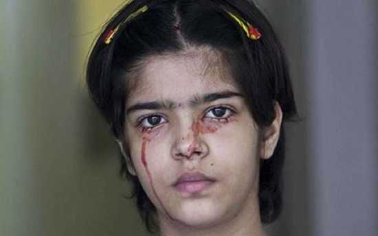 460-Blood-Girl1 1001140C