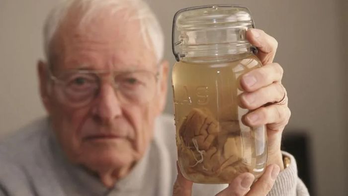 Thomas Harvey is seen holding a jar containing Einstein's brain.