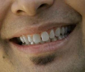Dental Health