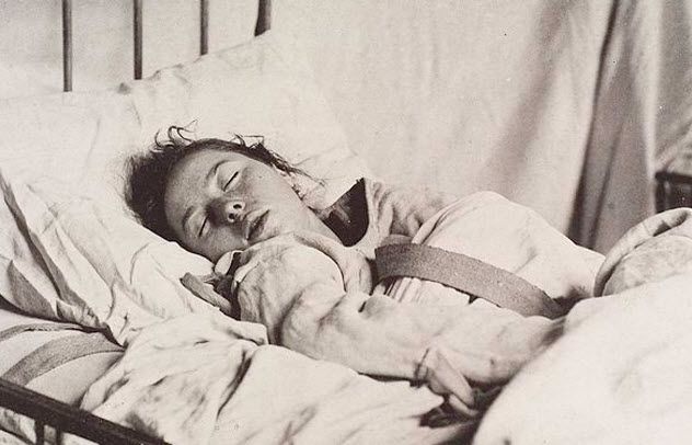 4b-epileptic-patient-asylum