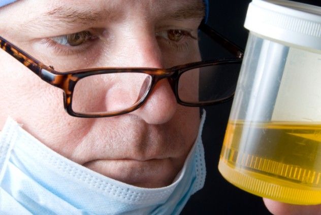 Urine Sample