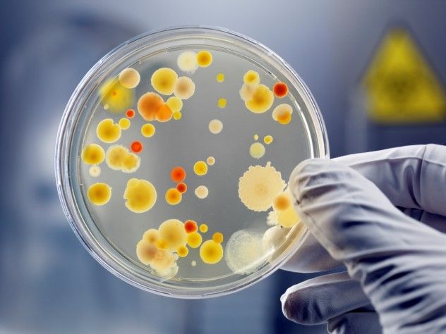 Bacteria-in-a-petri-dish-compressed