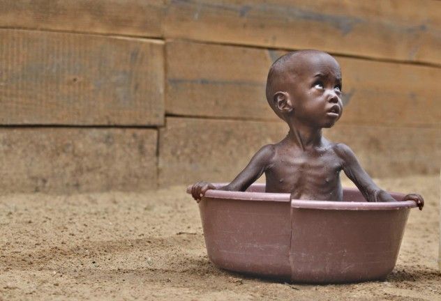 03e-east-africa-famine