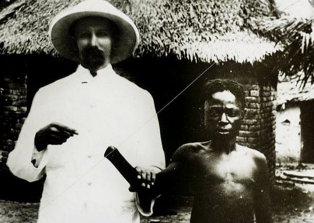 8a-congolese-with-severed-hand