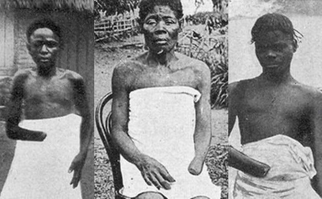 3a-mutilated-children