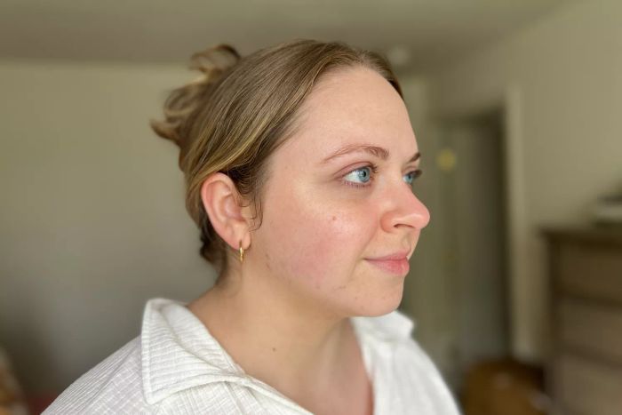 A person facing sideways after using SkinCeuticals Physical Fusion UV Defense SPF 50