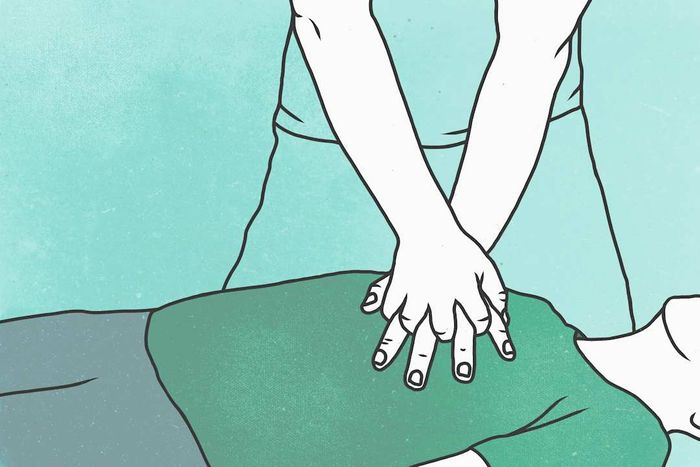 An illustration of someone performing CPR.