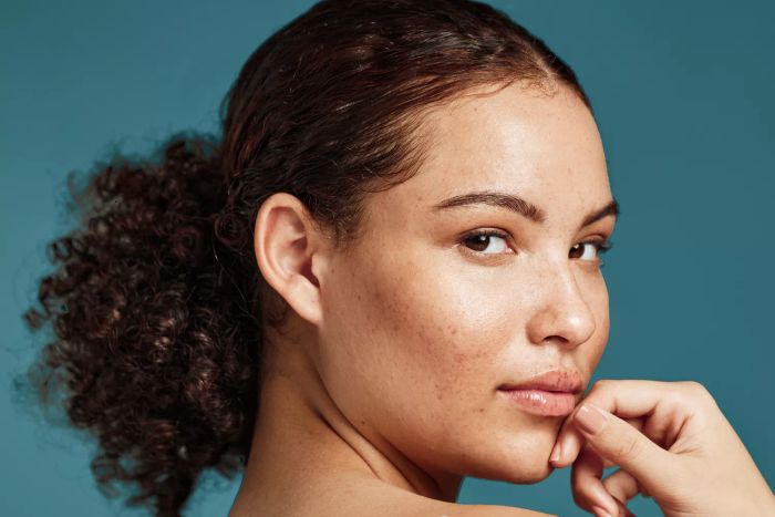 A stunning woman with no makeup.