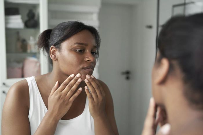 A young African-American woman dealing with acne issues in the bathroom.