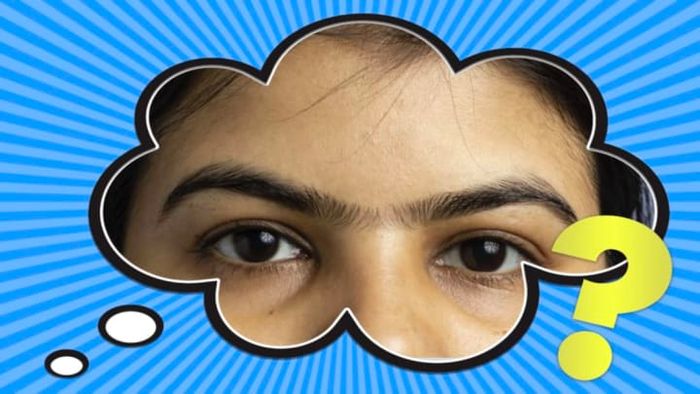 Few hair follicles cause as much distress as a synophrys, the medical term for a unibrow.