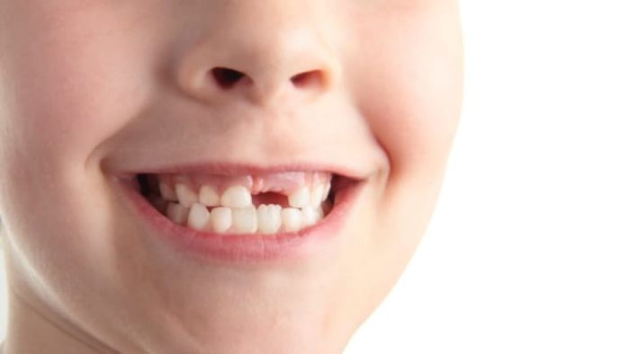 iStock