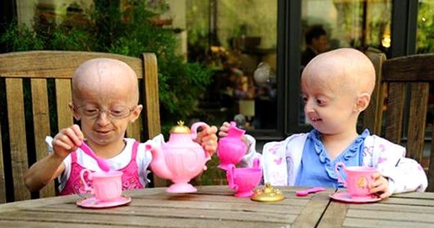 abc_progeria6995_100902_ssh