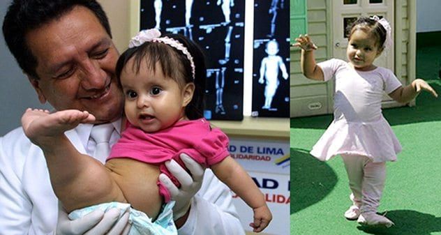 Milagros-Cerron-mermainsyndrome