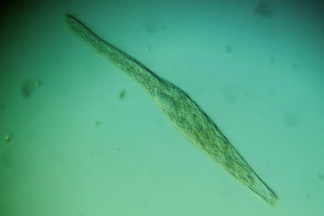 Spirostomum