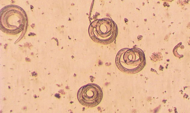 9-tapeworms_000037381758_Small