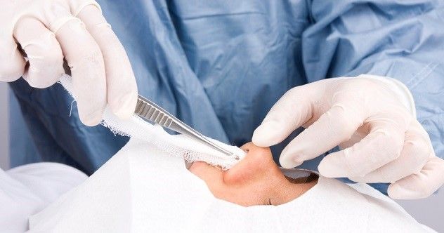 plastic surgery