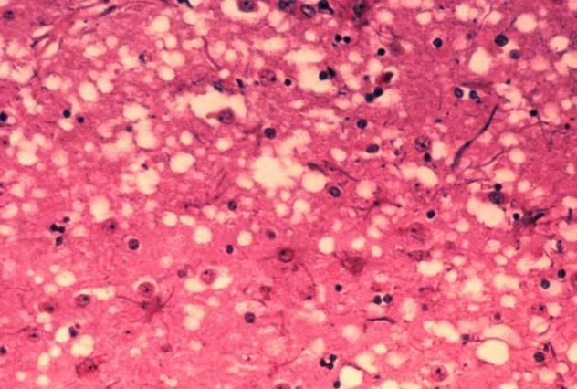 1_Histology_bse