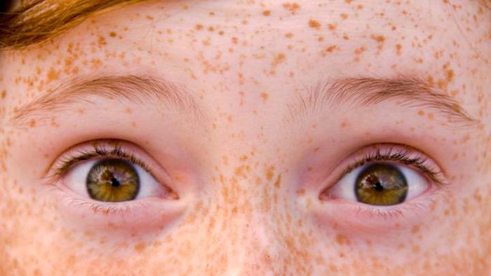 Red hair and freckles are traits that are influenced by our genes.