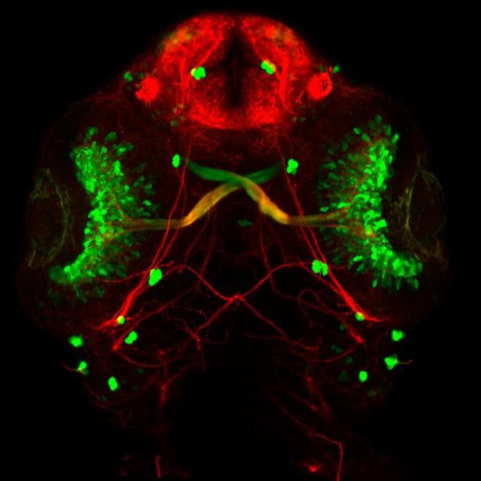 Microscopic photo of the eye development of a zebrafish.